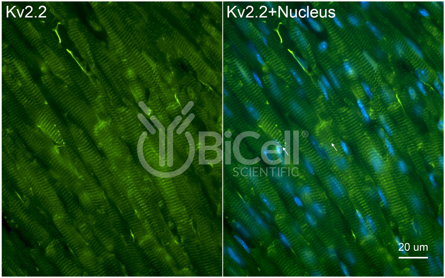 KCNB2 (Kv2.2) Antibody - Western Blot Validated