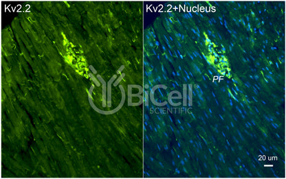 KCNB2 (Kv2.2) Antibody - Western Blot Validated