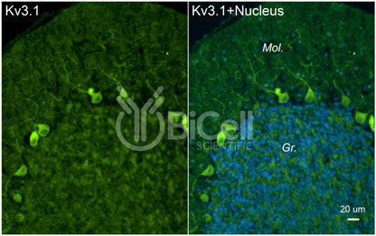 KCNC1 (Kv3.1) Antibody - FFPE Validated