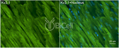 KCNC1 (Kv3.1) Antibody - FFPE Validated