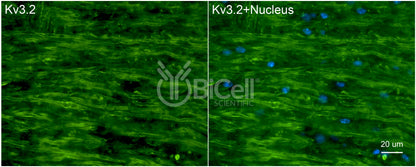 KCNC2 (Kv3.2) Antibody - FFPE Validated