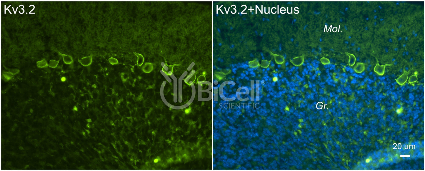 KCNC2 (Kv3.2) Antibody - Western Blot Validated