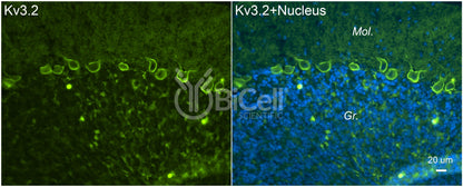 KCNC2 (Kv3.2) Antibody - FFPE Validated