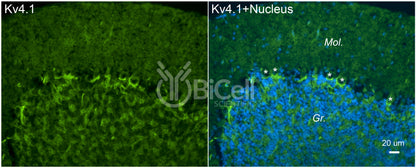 KCND1 (Kv4.1) Antibody - Western Blot Validated