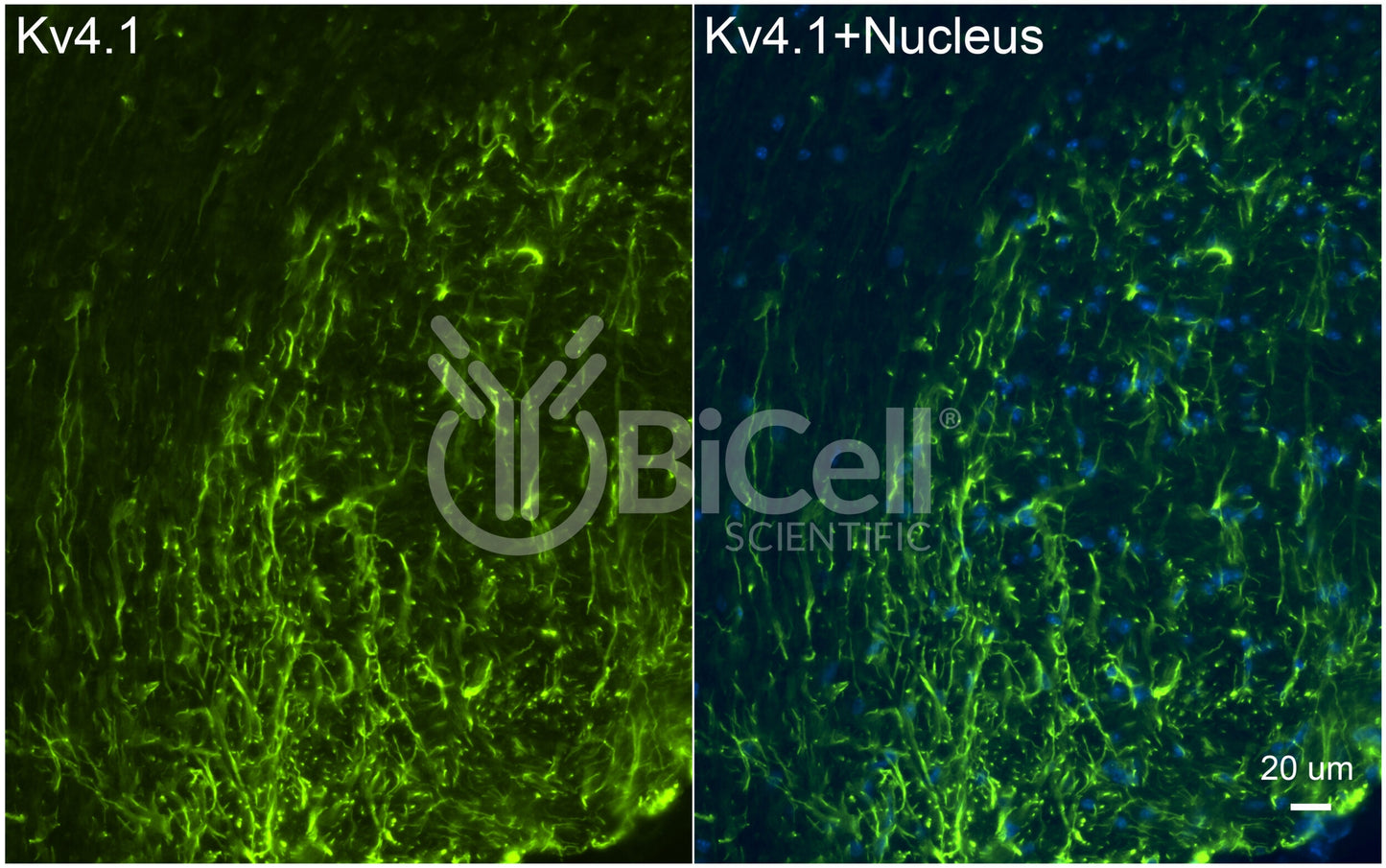 KCND1 (Kv4.1) Antibody