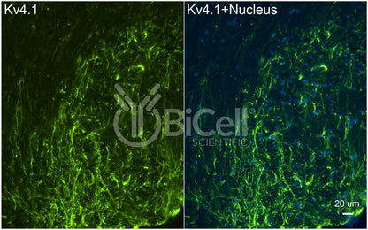 KCND1 (Kv4.1) Antibody