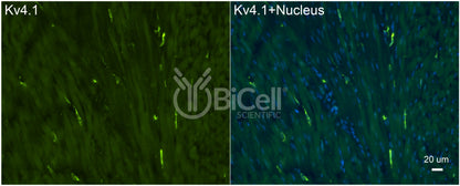 KCND1 (Kv4.1) Antibody - FFPE Validated