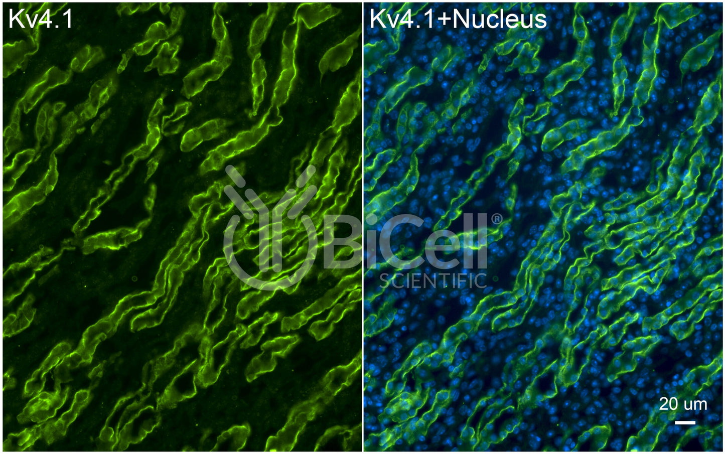 KCND1 (Kv4.1) Antibody