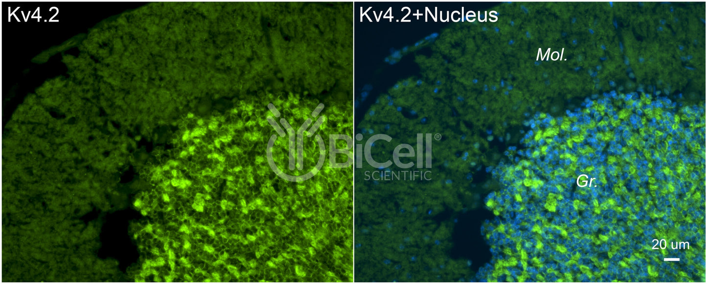 KCND2 (Kv4.2) Antibody - FFPE Validated