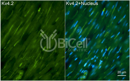 KCND2 (Kv4.2) Antibody - FFPE Validated