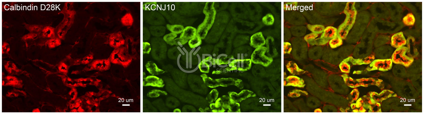 KCNJ10 (Kir4.1 or SeSAME) Antibody