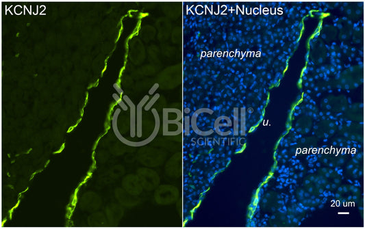 KCNJ2 (Kir2.1) Antibody