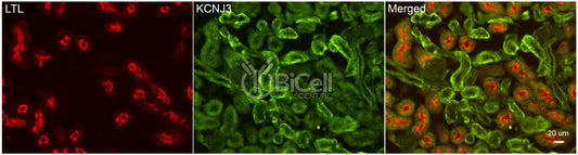 KCNJ3 (Kir3.1 or GIRK1) Antibody