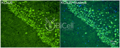 KCNJ5 (Kir3.4 or GIRK4) Antibody - Western Blot Validated