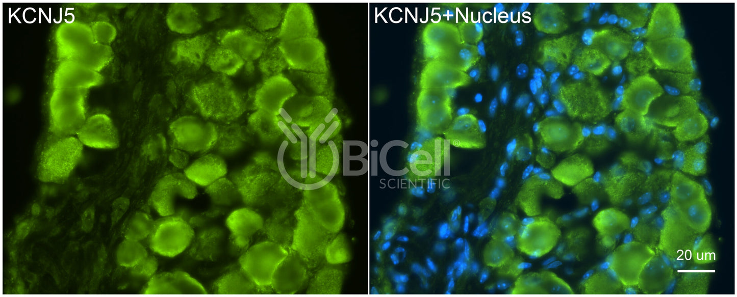 KCNJ5 (Kir3.4 or GIRK4) Antibody - Western Blot Validated