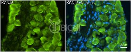 KCNJ5 (Kir3.4 or GIRK4) Antibody - Western Blot Validated