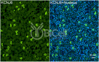 KCNJ6 (Kir3.2 or GIRK2) Antibody - Western Blot Validated