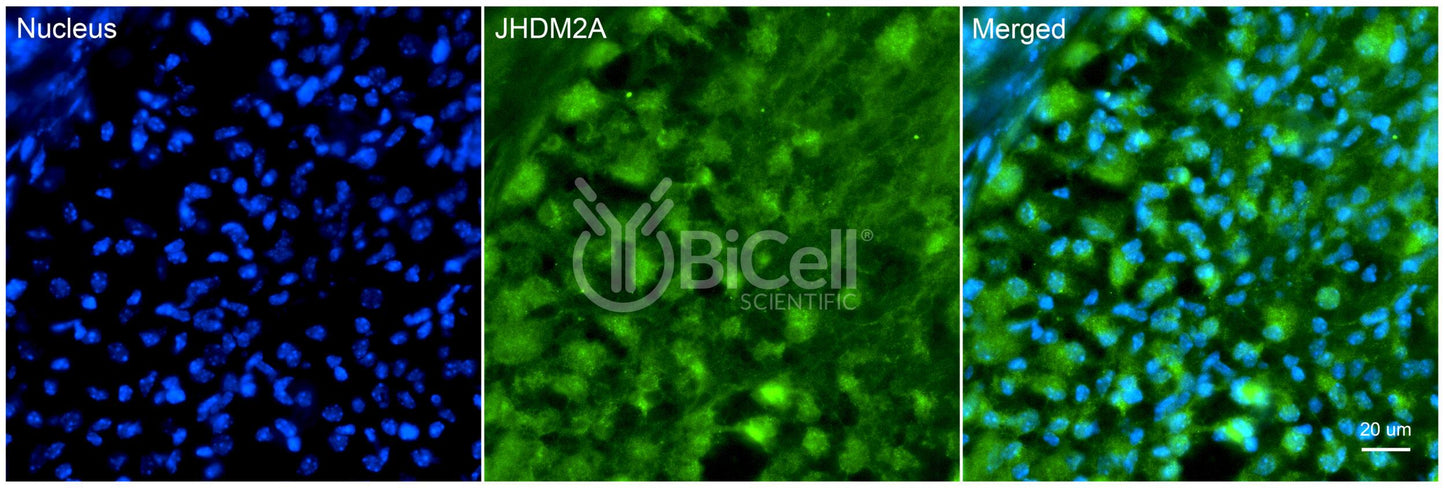 KDM3A (JHDM2A) Antibody - Western Blot Validated