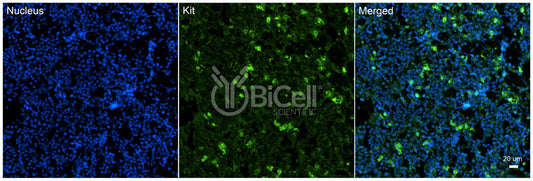 KIT (c-Kit or SCFR or CD117) Antibody - FFPE Validated