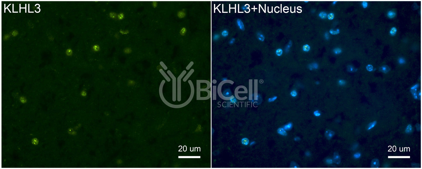 KLHL3 Antibody - FFPE Validated