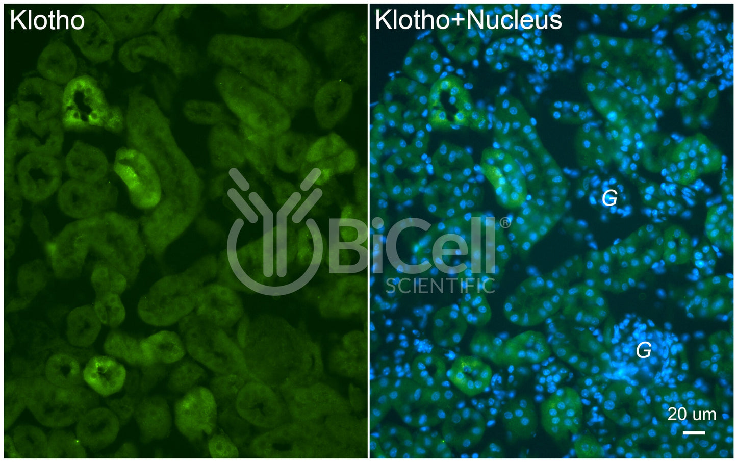 Klotho (KL) Antibody - FFPE Validated