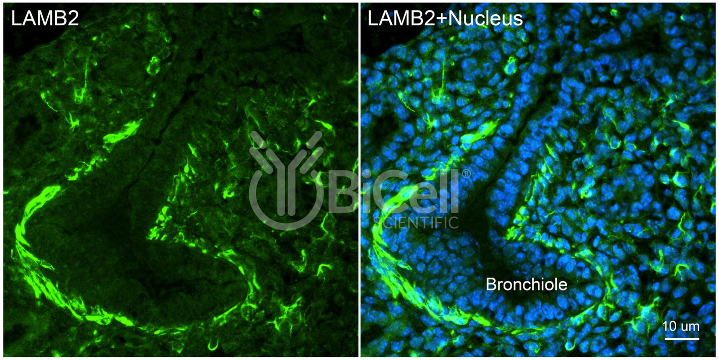 Laminin beta-2 (LAMB2) HiRe Antibody - Western Blot Validated