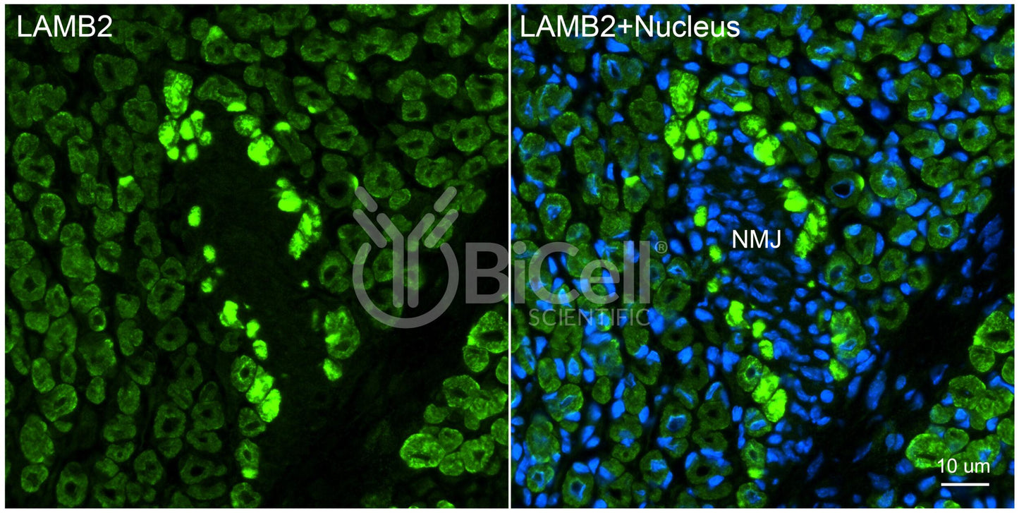 Laminin beta-2 (LAMB2) HiRe Antibody - Western Blot Validated