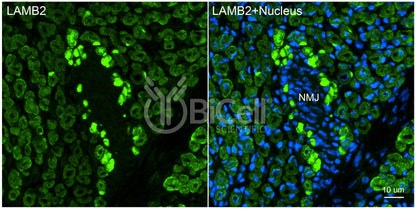 Laminin beta-2 (LAMB2) HiRe Antibody