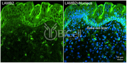 Laminin beta-2 (LAMB2) HiRe Antibody