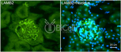 Laminin beta-2 (LAMB2) HiRe Antibody - Western Blot Validated