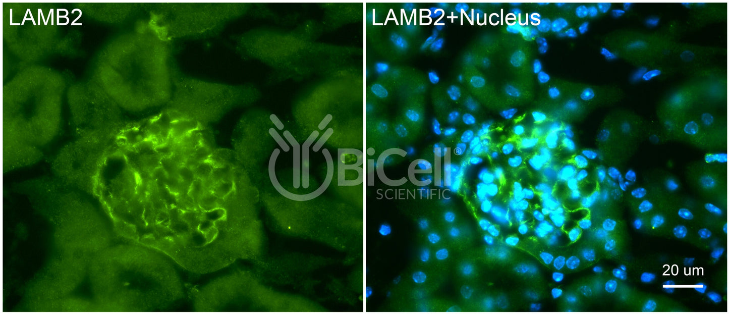 Laminin beta-2 (LAMB2) HiRe Antibody - FFPE Validated
