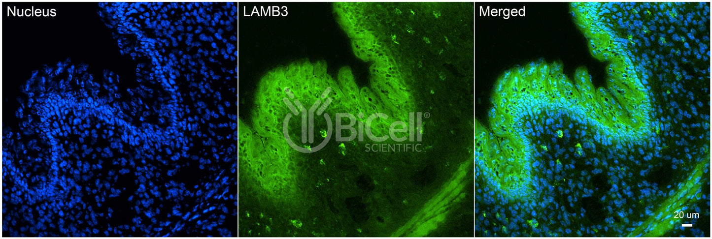 Laminin beta-3 (LAMB3) HiRe Antibody