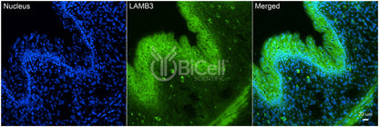 Laminin beta-3 (LAMB3) HiRe Antibody