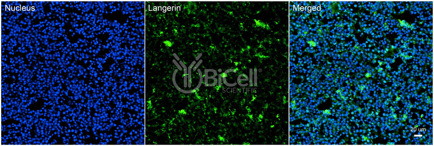 Langerin (CLEC4K or CD207) Antibody
