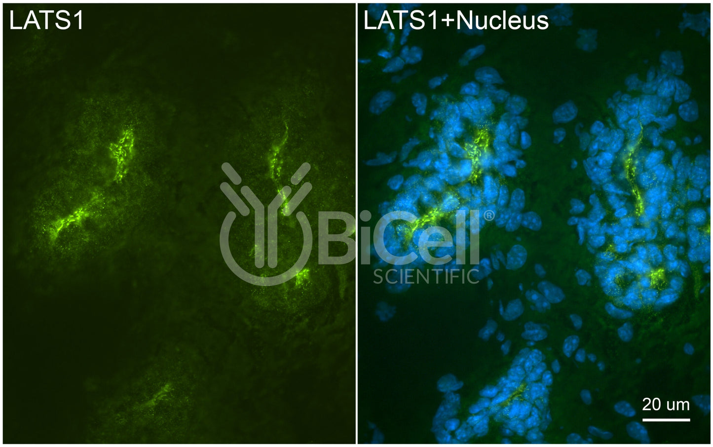 LATS1 (WARTS or wts) Antibody - Western Blot Validated