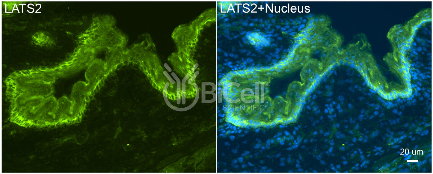 LATS2 (KPM) Antibody - Western Blot Validated