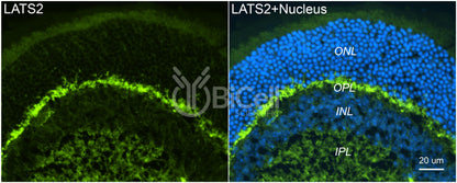 LATS2 (KPM) Antibody - FFPE Validated