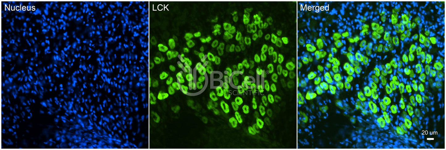 LCK (LSK) Antibody - Western Blot Validated