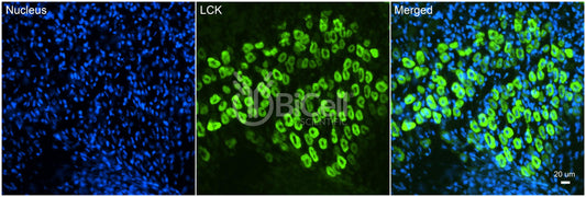 LCK (LSK) Antibody - FFPE Validated