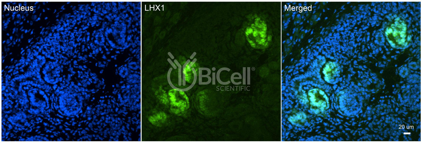 LHX1 (LIM1) Antibody - FFPE Validated