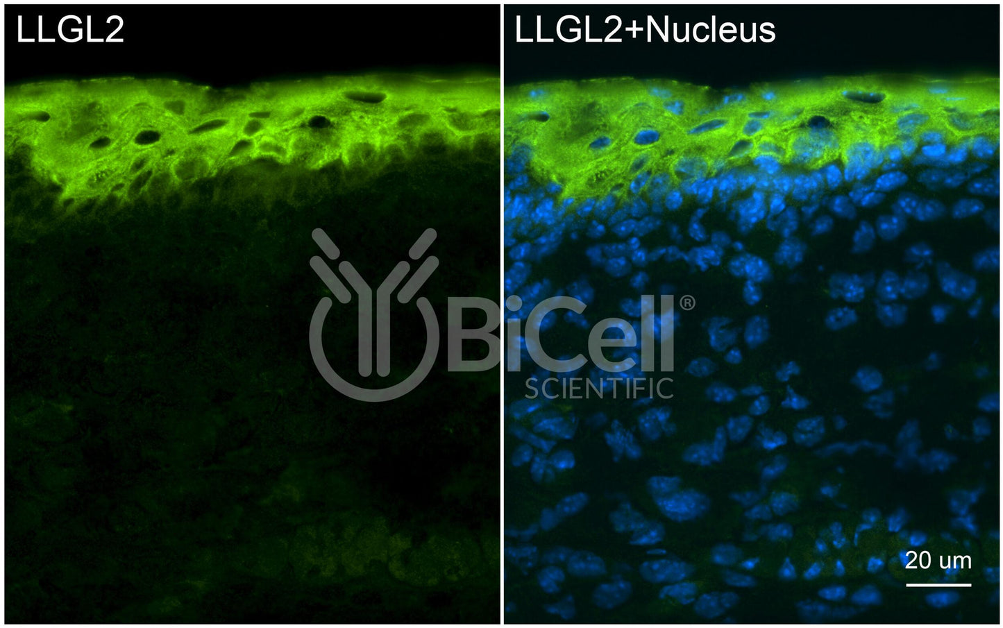 LLGL2 (LGL2) Antibody - Western Blot Validated