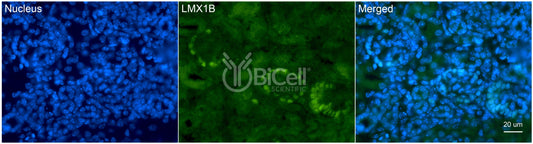 LMX1B Antibody