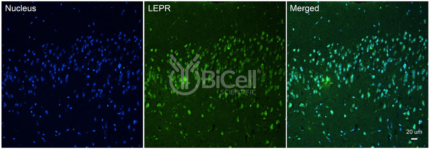 Leptin receptor (LEPR or CD295) Antibody - FFPE Validated