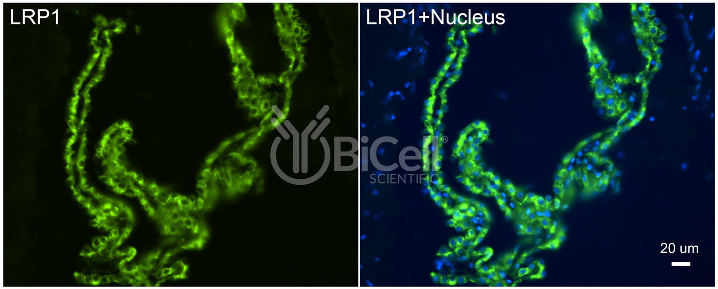 LRP1 (CD91) Antibody - FFPE Validated
