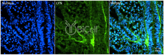 LYN (JTK8) Antibody - Western Blot Validated