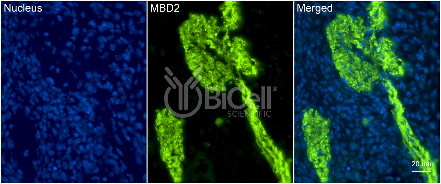 MBD2 (DMTase) Antibody - FFPE Validated