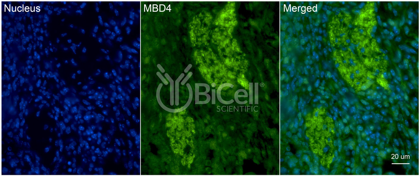 MBD4 (MED1) Antibody - Western Blot Validated