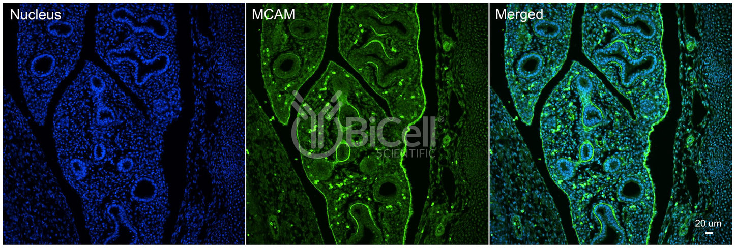 MCAM (CD146 or MUC18) Antibody - Western Blot Validated