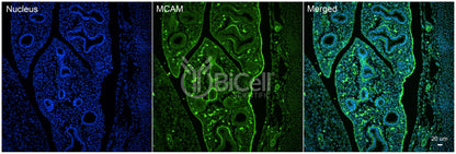 MCAM (CD146 or MUC18) Antibody - Western Blot Validated