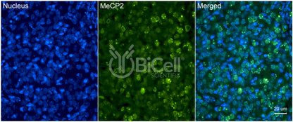 MeCP2 Antibody - Western Blot Validated